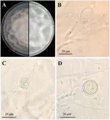 Photograph under microscope showing A: a seven-day-old colony on PARP medium; B: sporangia; C: gametangia; D: oospore.