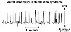 A line graph. The line has pronounced upwards spikes followed by less pronounced downward spikes. These spikes are separated by longer intermittent periods where the line is jagged, but roughly and statistically straight.