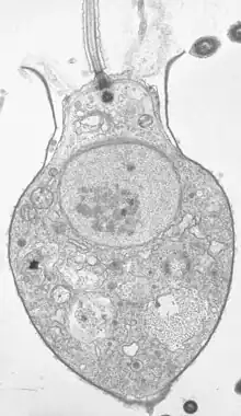 Choanoflagellate