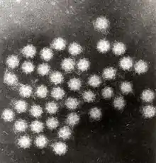 Transmission electron micrograph of Sapporo viruses