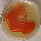 Serratia marcescens: red pigmentation: although considered characteristic of the species, only about 10% of specimens produce this pigment: 236 