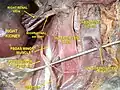 Inferior vena cava front view