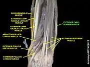 Extensor carpi ulnaris muscle