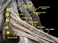 Brachial plexus.Deep dissection.