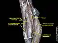 Muscles of the back of the leg. Deep layer.