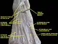 Inferior extensor retinaculum of foot.Deep dissection.