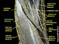 Sartorius muscle