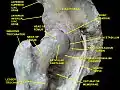 Hip joint. Lateral view.Greater trochanter.