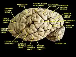 Cerebrum. Lateral view. Deep dissection.