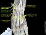 Extensor pollicis brevis muscle