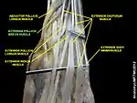 Extensor pollicis brevis muscle