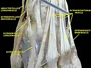 Muscle of the hand. Posterior view.