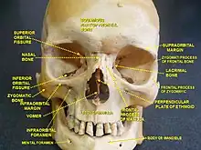 Inferior orbital fissure.