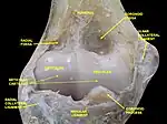 Elbow joint. Deep dissection. Anterior view.