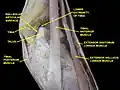 Dorsum of Foot. Ankle joint. Deep dissection.