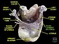 Round ligament of uterus