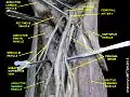 Adductor magnus muscle