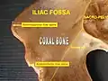 Iliac fossa