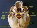 Zygomatic arch, base of skull