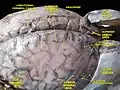 Meninges and superficial cerebral veins.Deep dissection.Superior view.