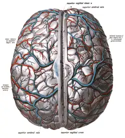 Brain with sagittal sinus at centre, with various lacunae.