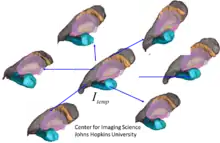 figure depicting multiple coordinate systems generated from MRI images and generating a common template coordinate system.