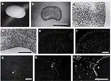 Later embryonic stages of "Asthenosoma ijiinai"