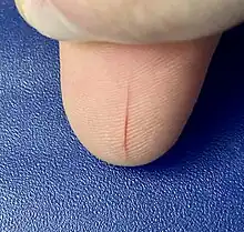 An open paper cut, a few mintes after injury, on the right thumb.