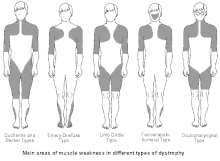 five body outlines, muscle areas outlines