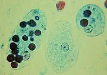 Trophozoites of E. histolytica with ingested erythrocytes