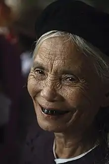 Image 10A Kinh Vietnamese woman with blackened teeth due to chewing betel nut, a common practice in Vietnam (from Culture of Vietnam)