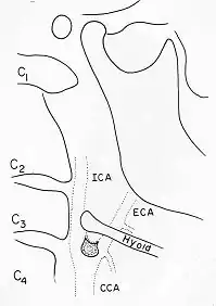 X-ray64B