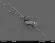 Aplanochytrium, SEM showing one vegetative cell and extended ectoplasmic network.