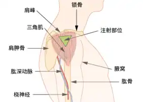 三角肌注射区域