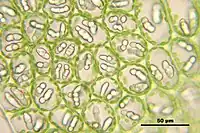 Oil bodies in Nardia scalaris, a leafy liverwort