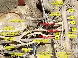 Brachial plexus