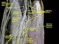 Femoral artery.Deep dissection.