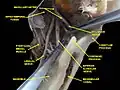 Infratemporal fossa. Lingual and inferior alveolar nerve. Deep dissection. Anterolateral view